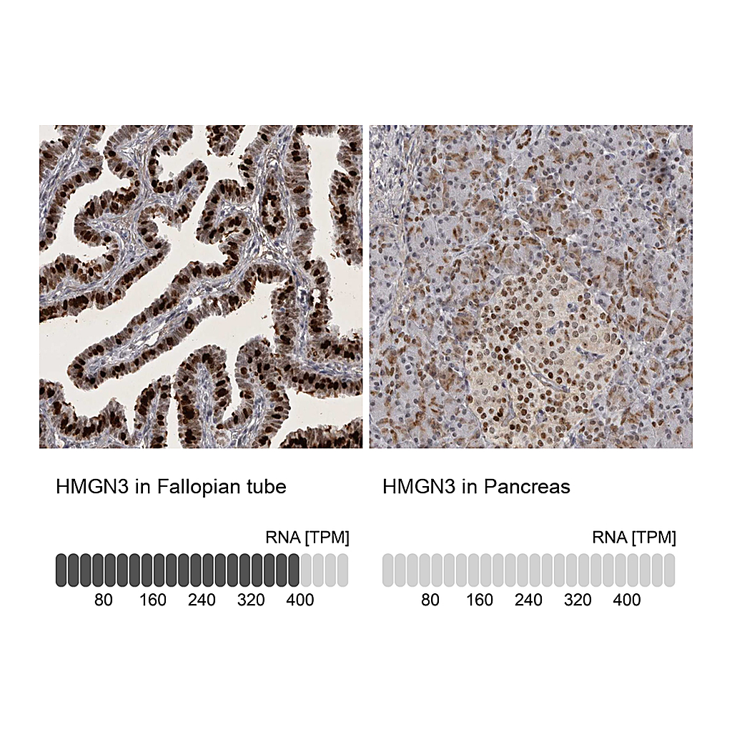 Atlas Antibodies Anti-HMGN3 Antibody