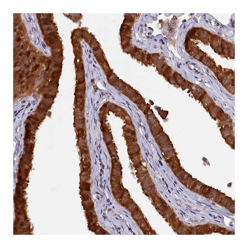 Atlas Antibodies Anti-HN1L Antibody