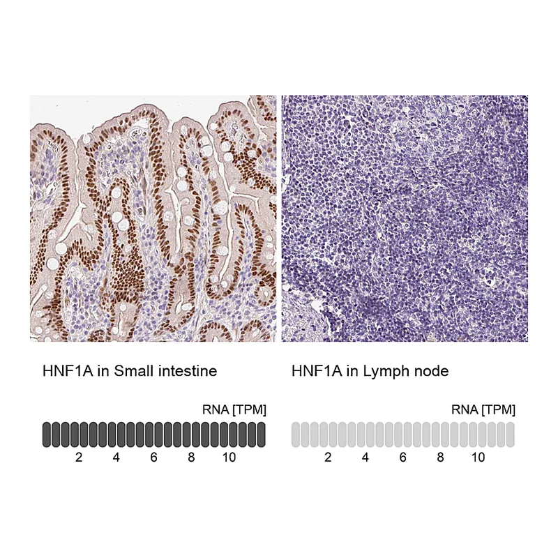 Atlas Antibodies Anti-HNF1A Antibody