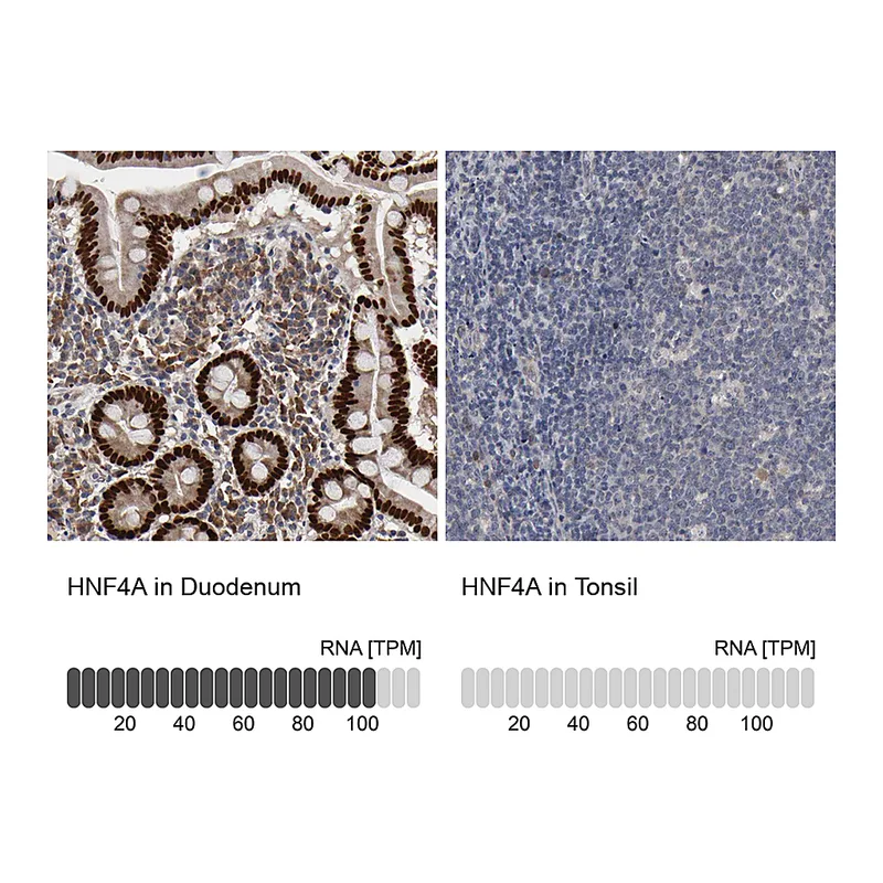 Atlas Antibodies Anti-HNF4A Antibody