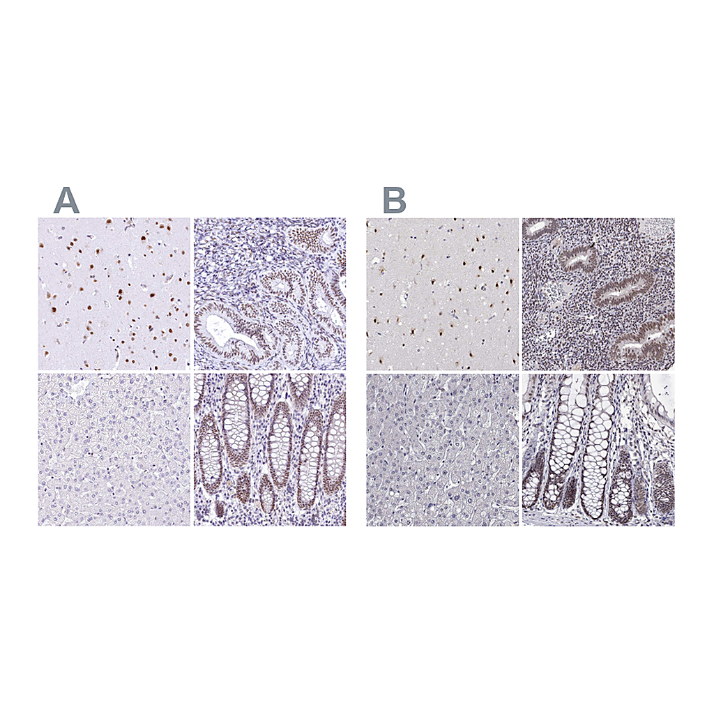 Atlas Antibodies Anti-HNRNPA0 Antibody