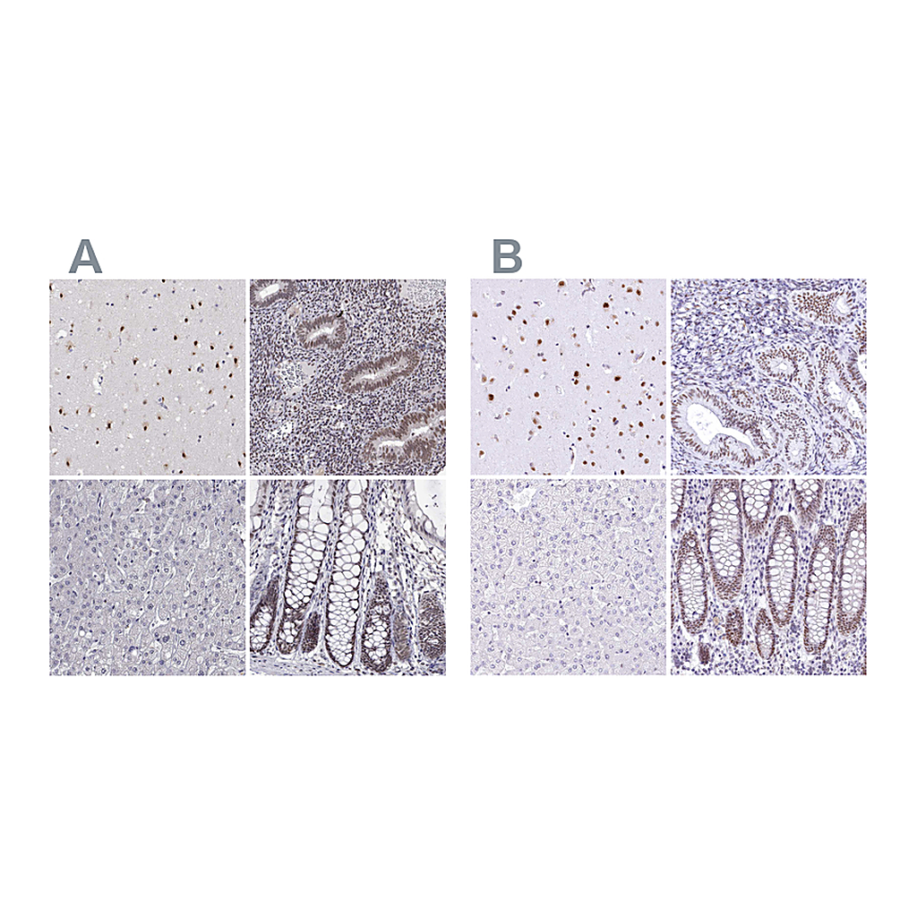 Atlas Antibodies Anti-HNRNPA0 Antibody