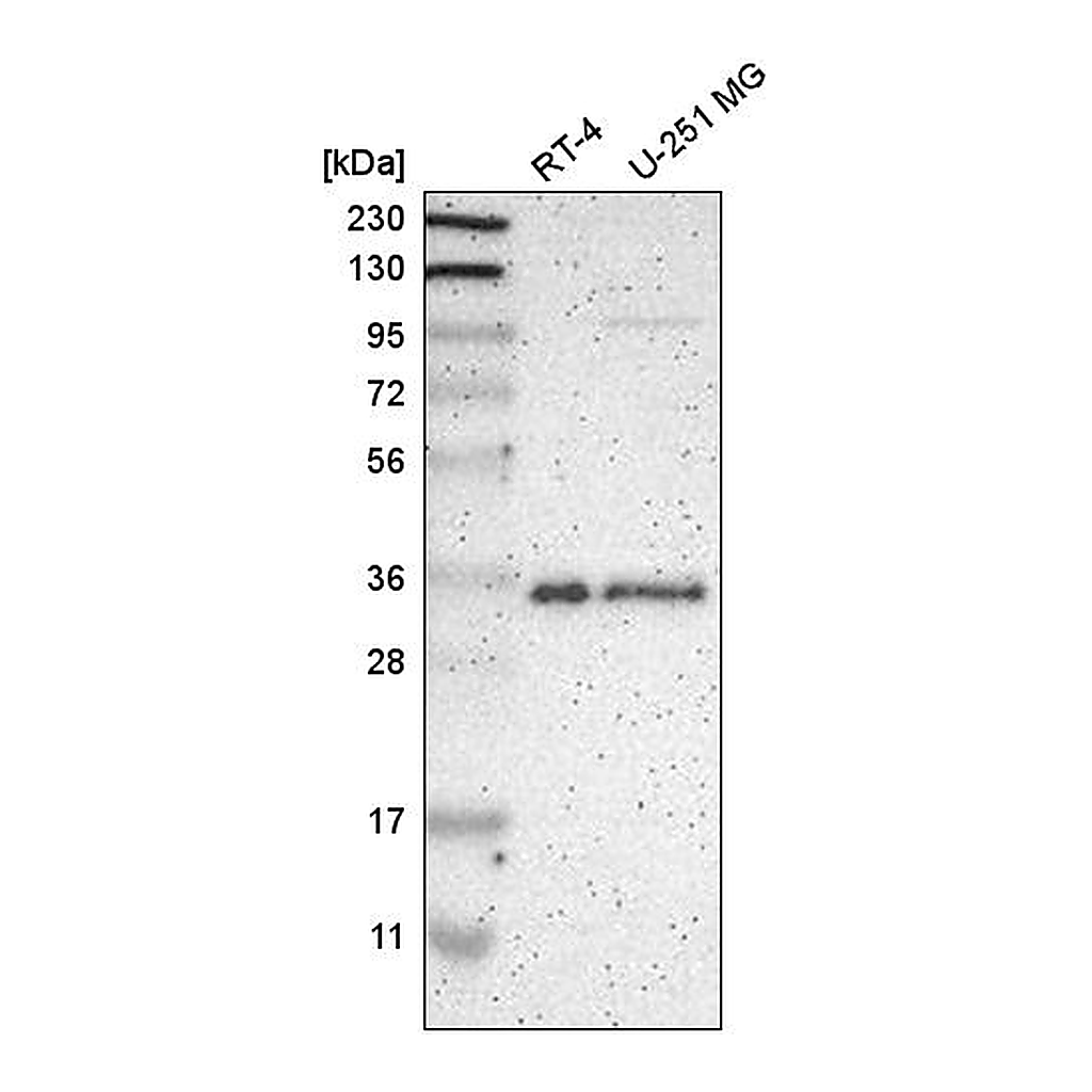 Atlas Antibodies Anti-HNRNPA1 Antibody