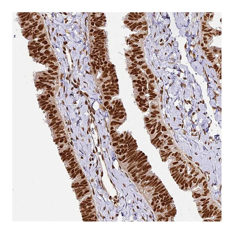 Atlas Antibodies Anti-HNRNPA1 Antibody