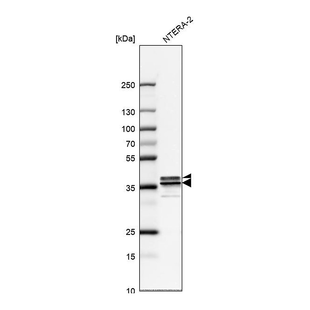Atlas Antibodies Anti-HNRNPA2B1 Antibody