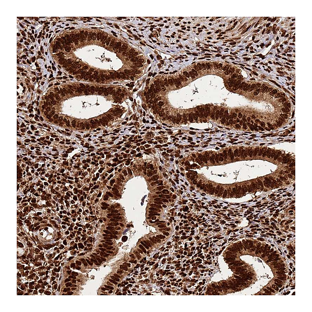 Atlas Antibodies Anti-HNRNPAB Antibody