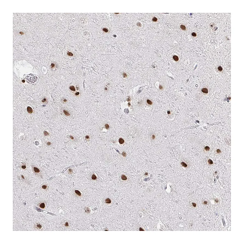 Atlas Antibodies Anti-HNRNPDL Antibody