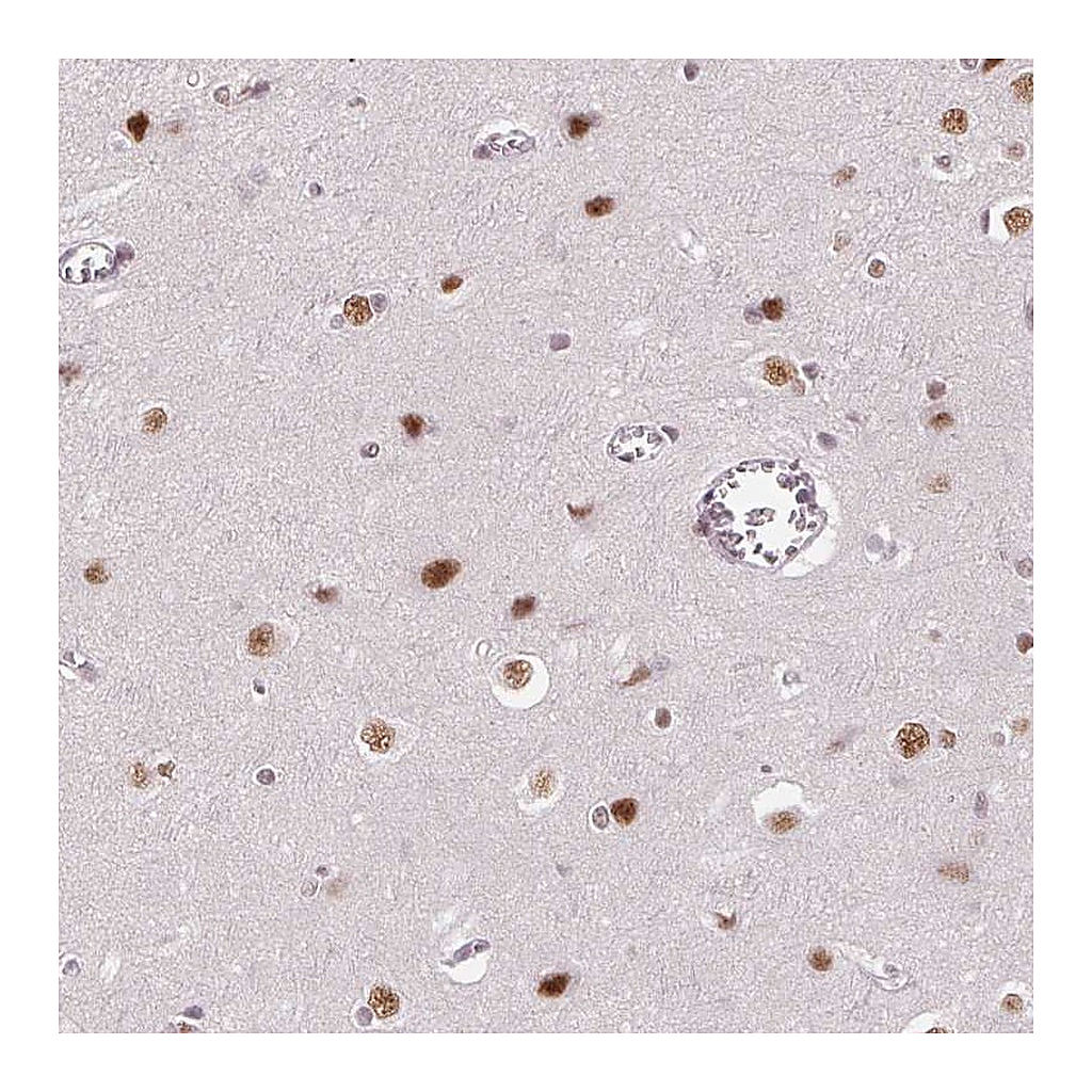 Atlas Antibodies Anti-HNRNPDL Antibody