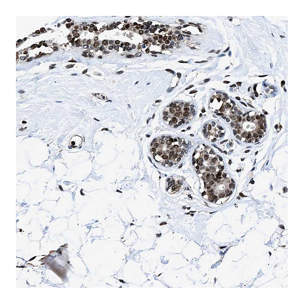 Atlas Antibodies Anti-HNRNPH2 Antibody