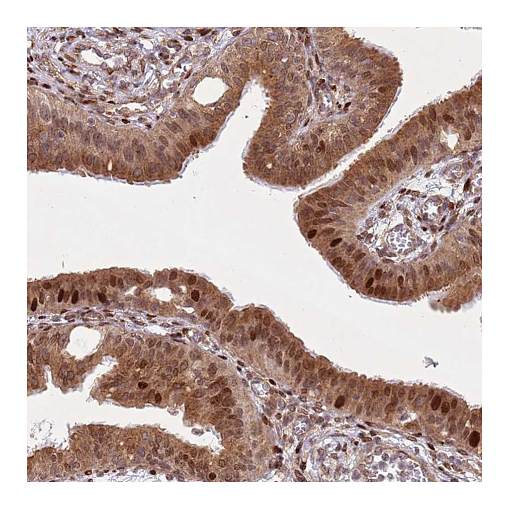 Atlas Antibodies Anti-HNRNPLL Antibody