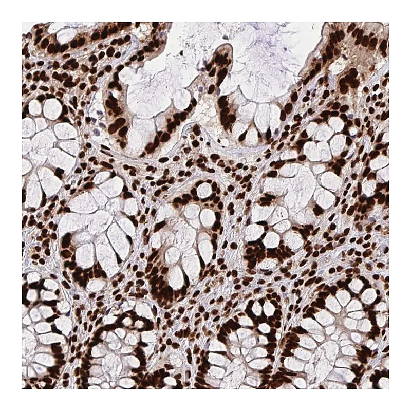 Atlas Antibodies Anti-HNRNPL Antibody