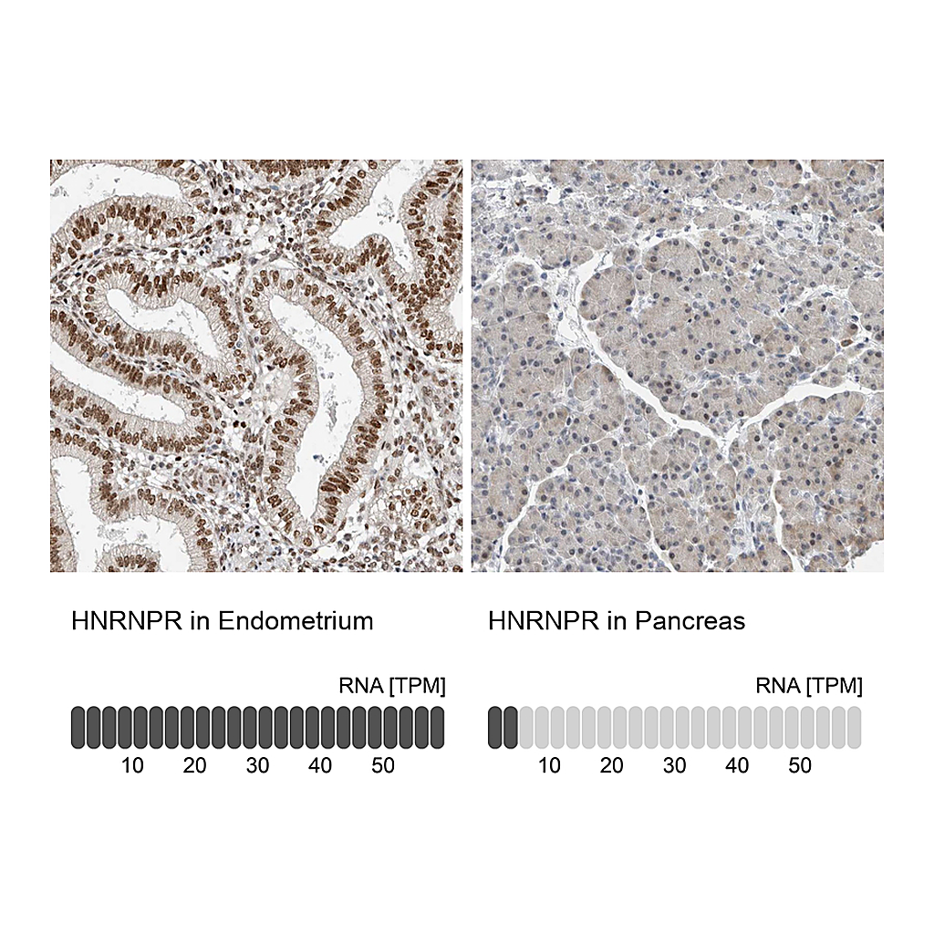Atlas Antibodies Anti-HNRNPR Antibody