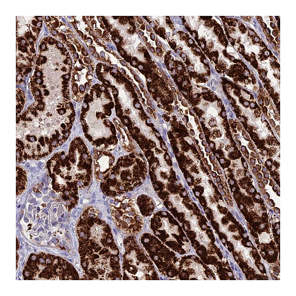 Atlas Antibodies Anti-HOGA1 Antibody