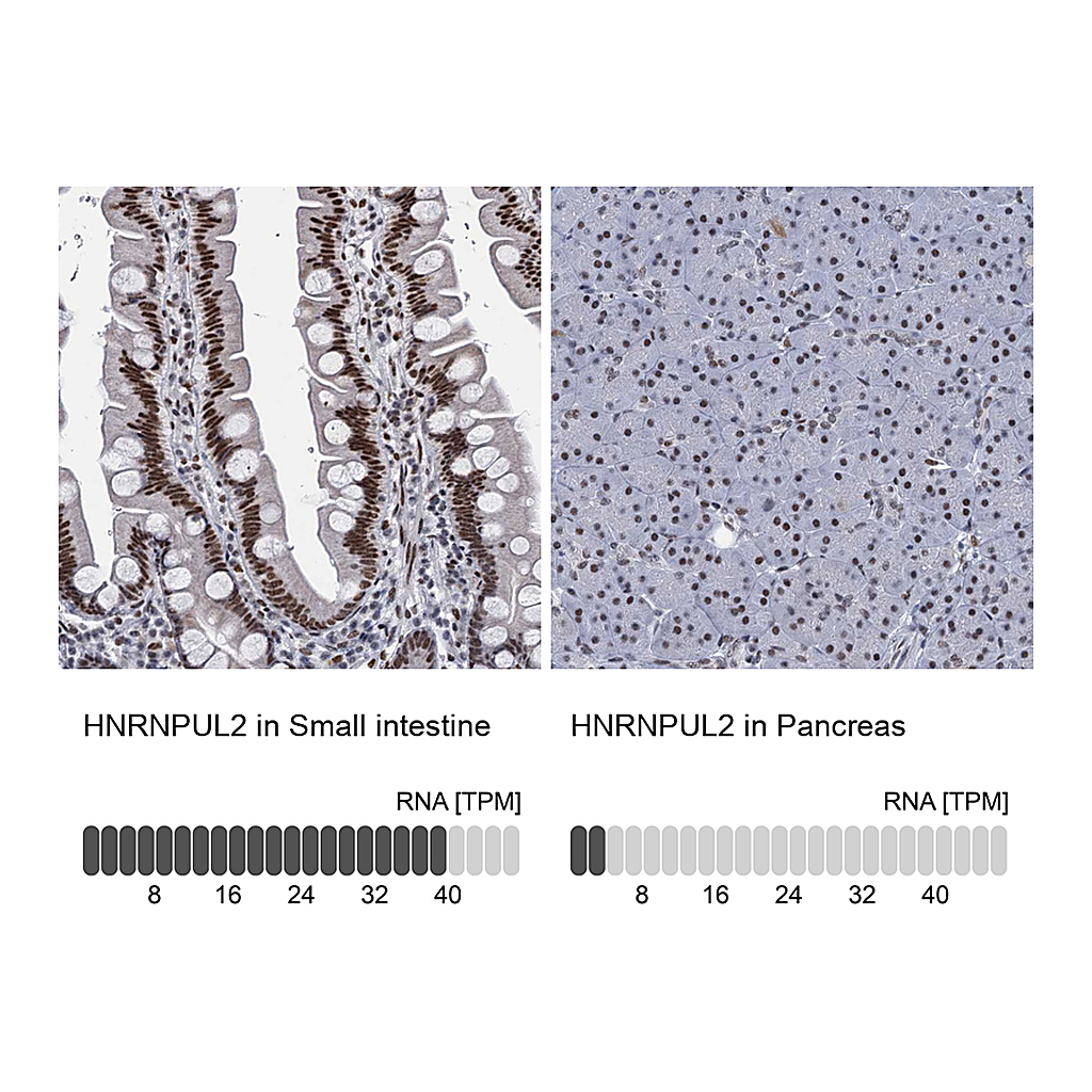 Atlas Antibodies Anti-HNRNPUL2 Antibody