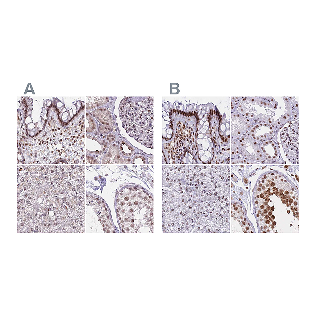Atlas Antibodies Anti-HNRNPUL1 Antibody