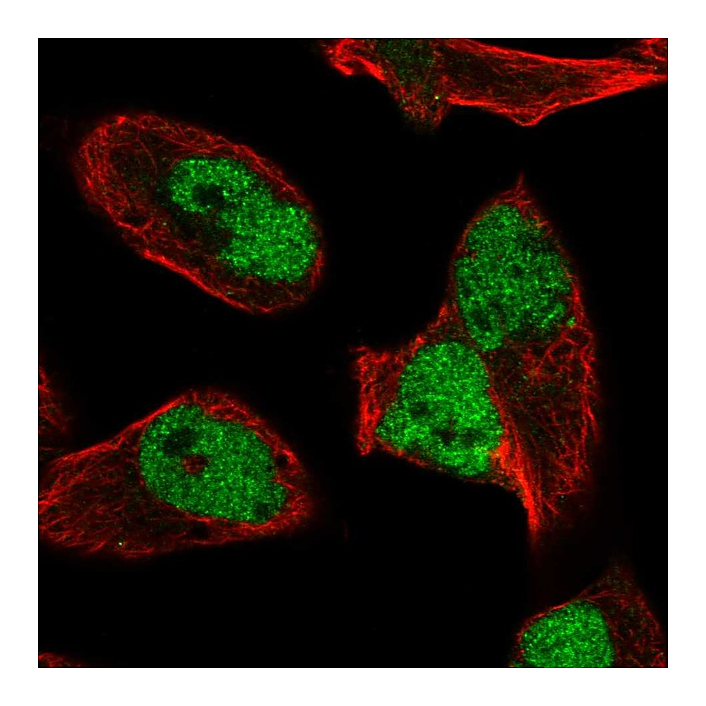 Atlas Antibodies Anti-HNRNPUL2 Antibody