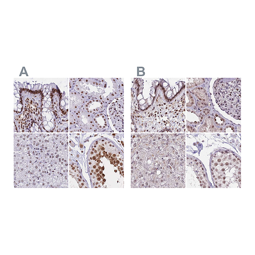 Atlas Antibodies Anti-HNRNPUL1 Antibody