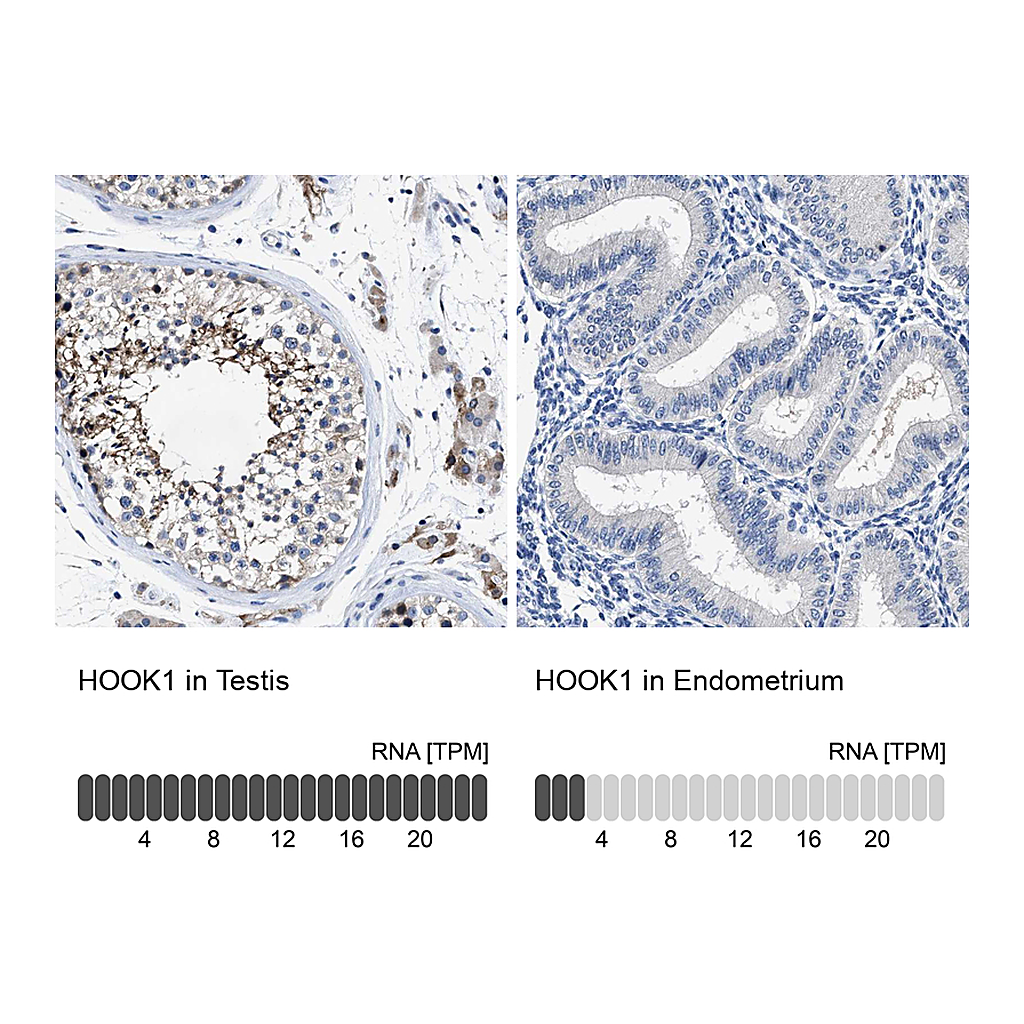 Atlas Antibodies Anti-HOOK1 Antibody