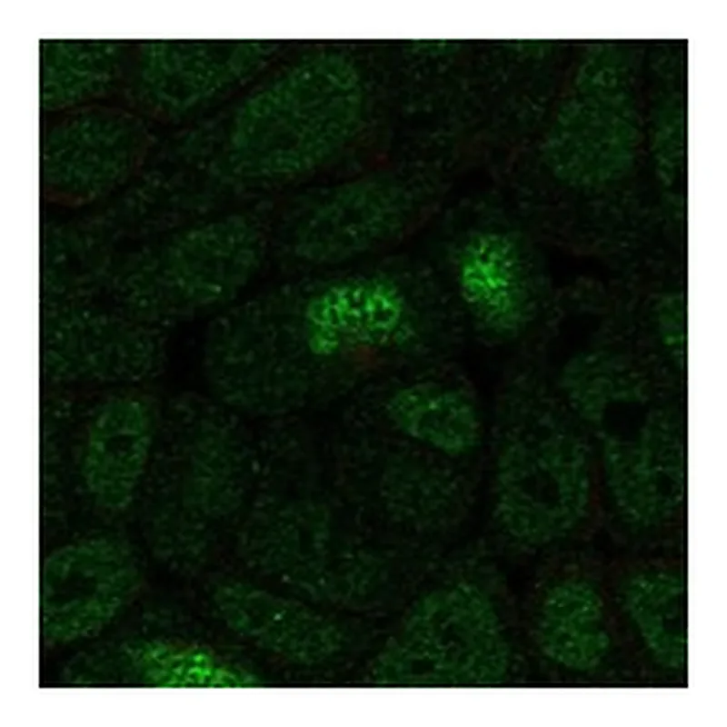 Atlas Antibodies Anti-HOXA13 Antibody