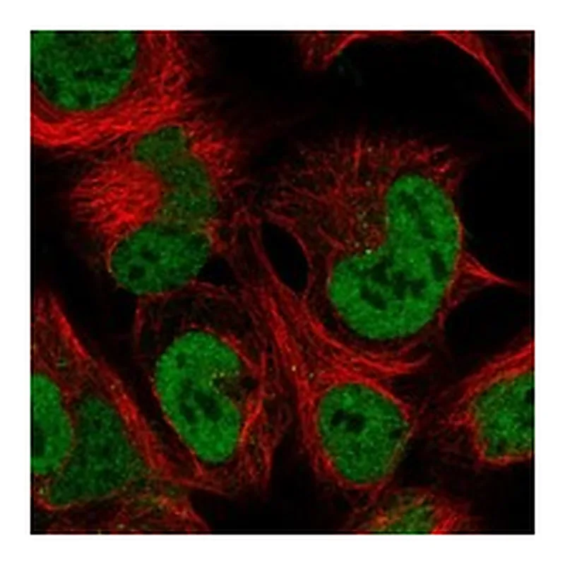 Atlas Antibodies Anti-HOXA10 Antibody
