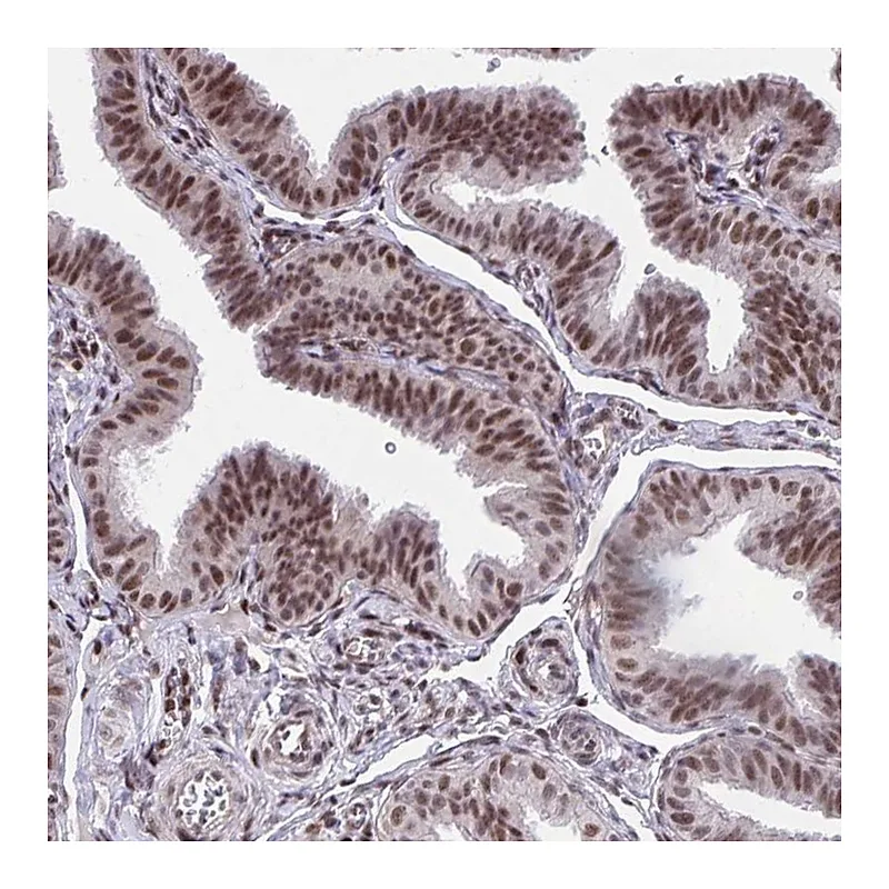 Atlas Antibodies Anti-HOXA4 Antibody