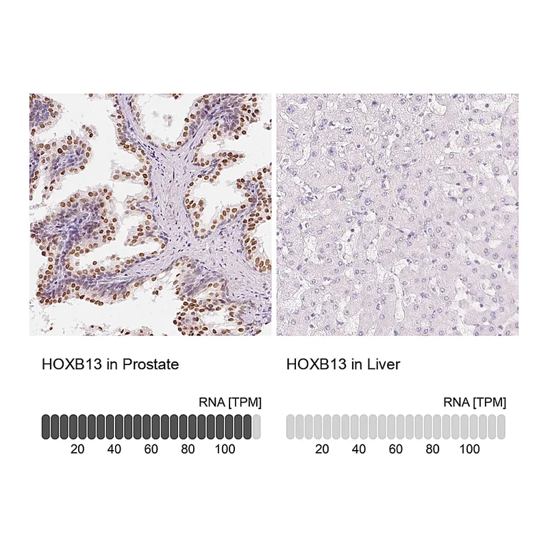 Atlas Antibodies Anti-HOXB13 Antibody
