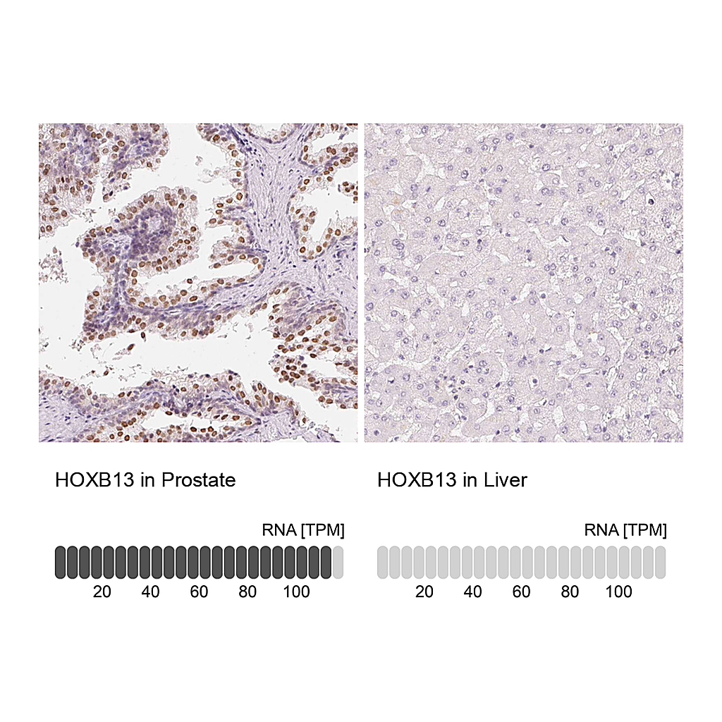 Atlas Antibodies Anti-HOXB13 Antibody