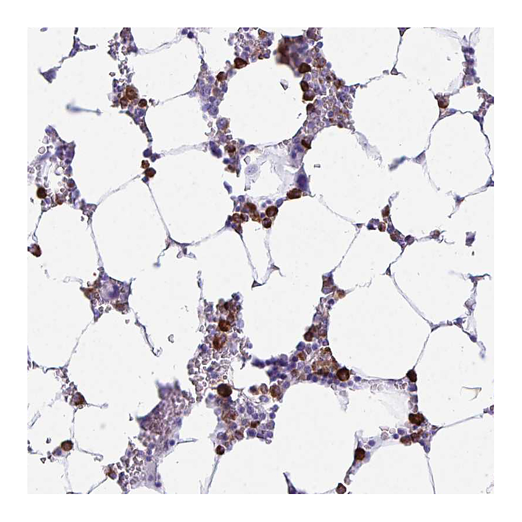 Atlas Antibodies Anti-HOXB4 Antibody