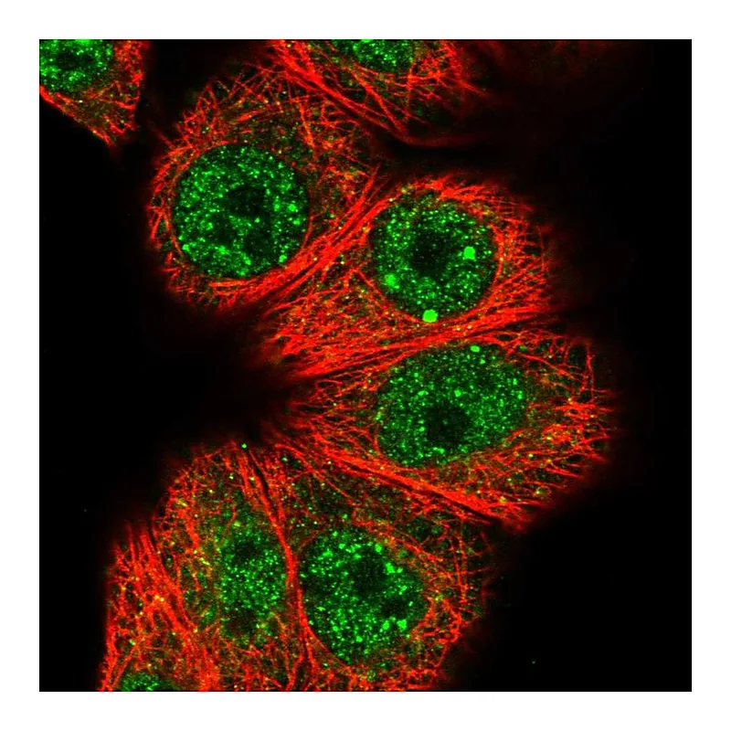 Atlas Antibodies Anti-HOXB7 Antibody