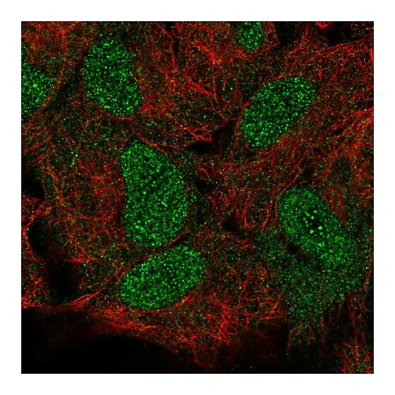 Atlas Antibodies Anti-HOXB5 Antibody