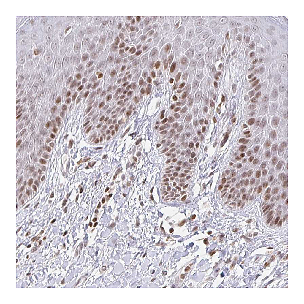 Atlas Antibodies Anti-HOXC10 Antibody