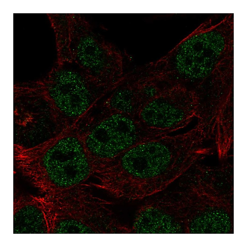 Atlas Antibodies Anti-HOXB8 Antibody