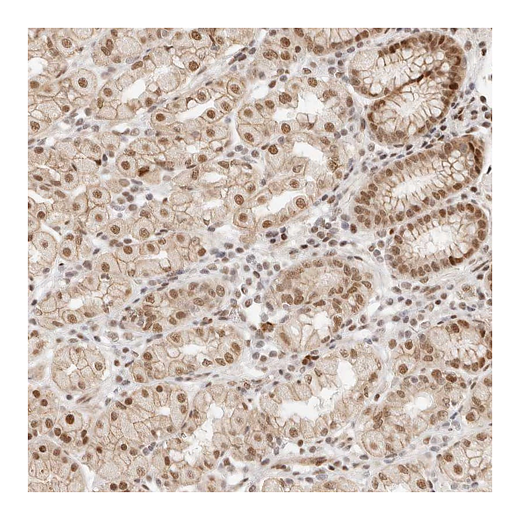 Atlas Antibodies Anti-HOXC5 Antibody