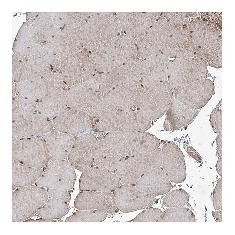 Atlas Antibodies Anti-HOXC8 Antibody