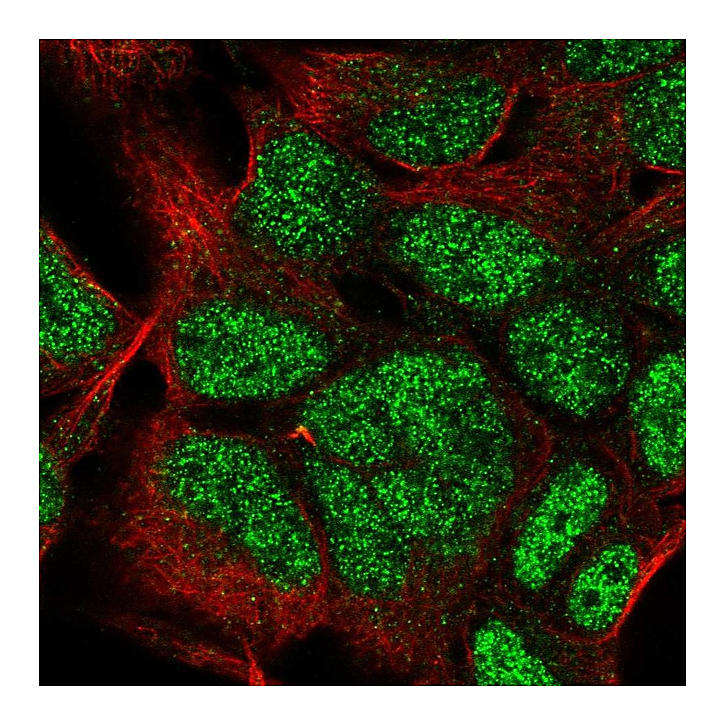 Atlas Antibodies Anti-HOXC9 Antibody