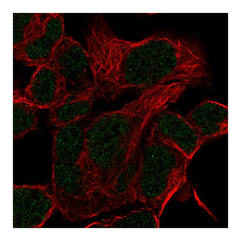 Atlas Antibodies Anti-HOXD11 Antibody