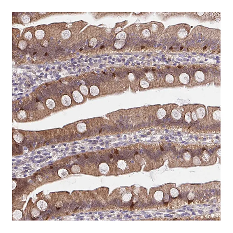 Atlas Antibodies Anti-HOXD12 Antibody
