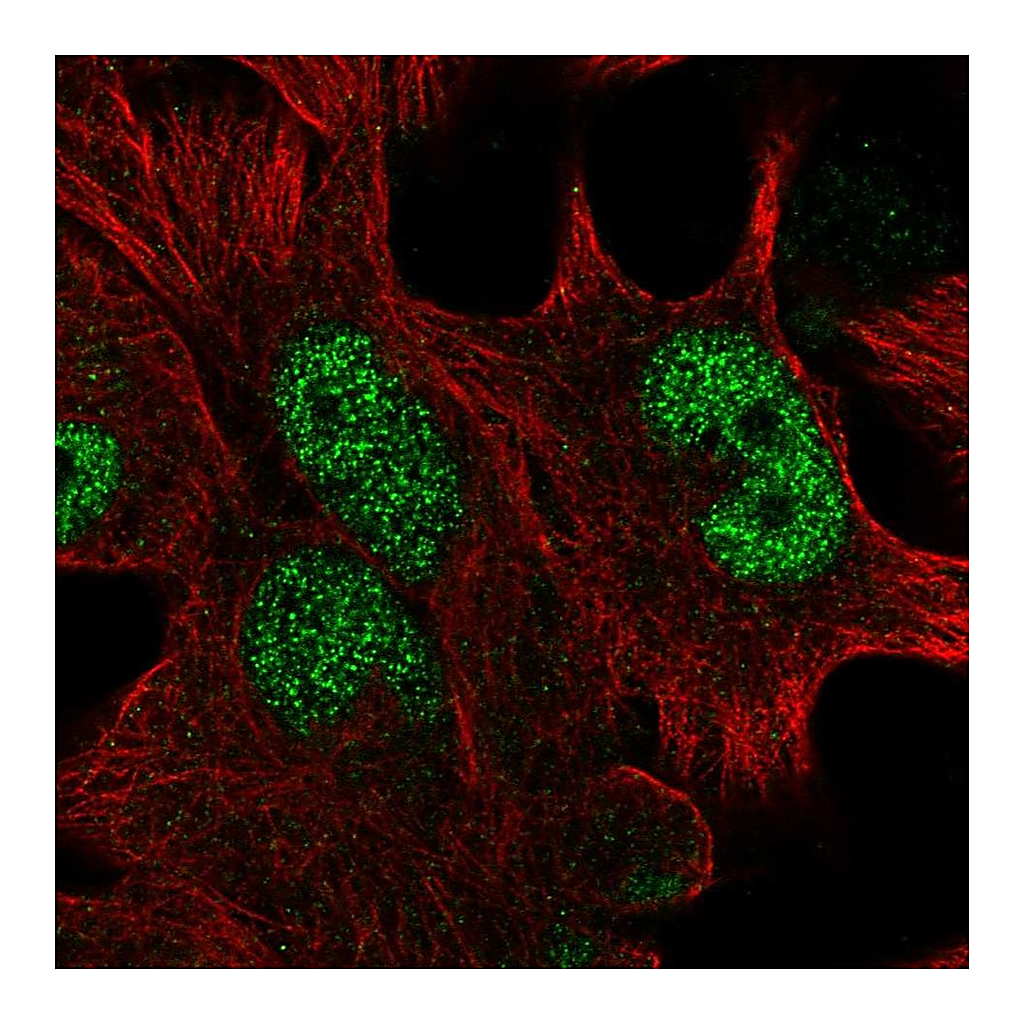 Atlas Antibodies Anti-HOXD13 Antibody