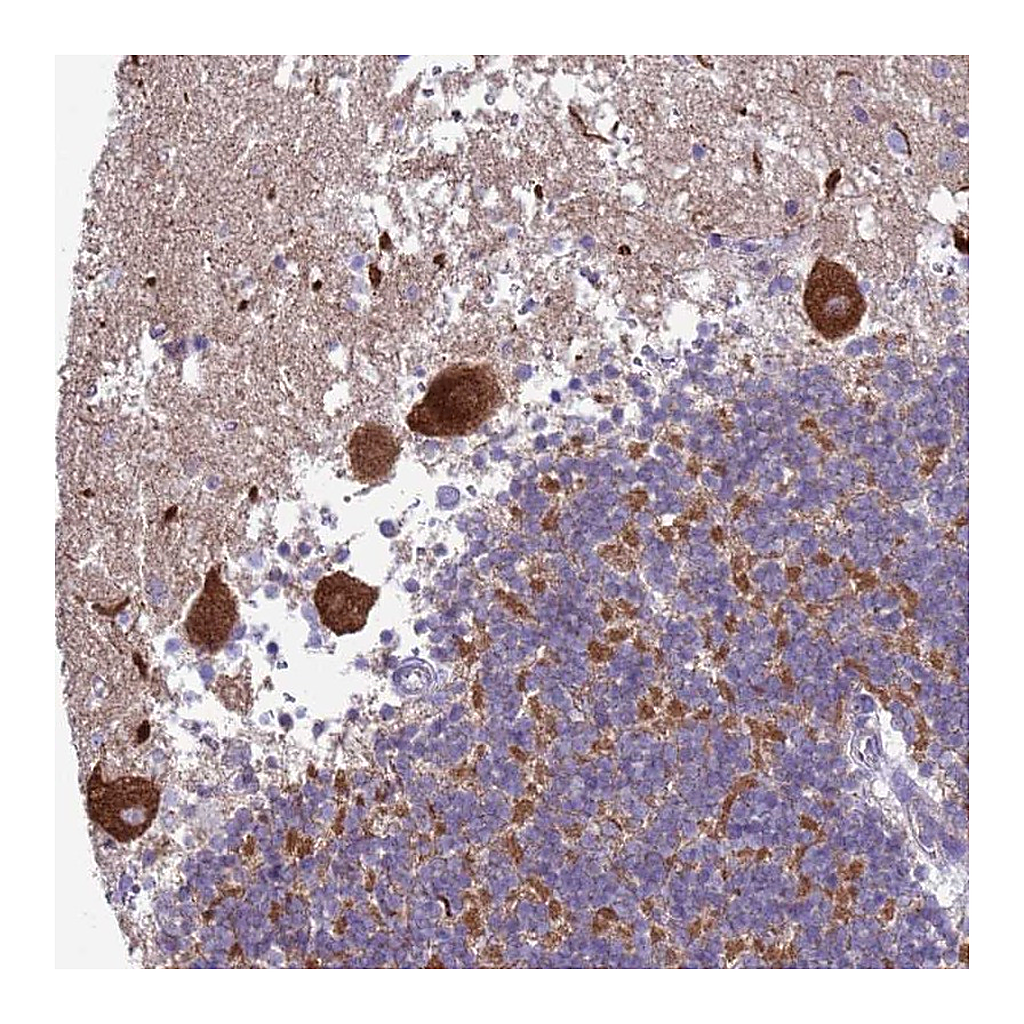 Atlas Antibodies Anti-HPCA Antibody