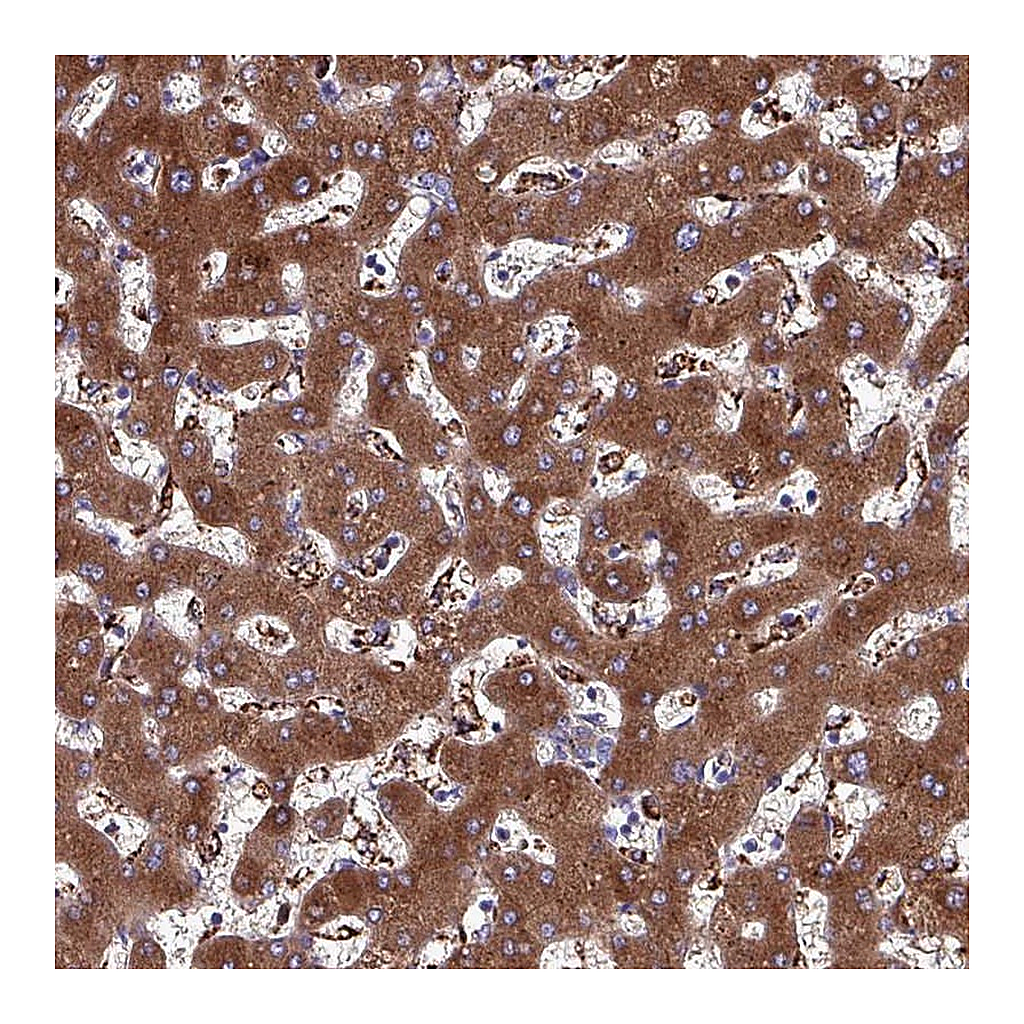Atlas Antibodies Anti-HP Antibody