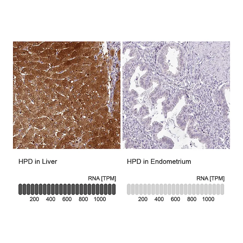Atlas Antibodies Anti-HPD Antibody