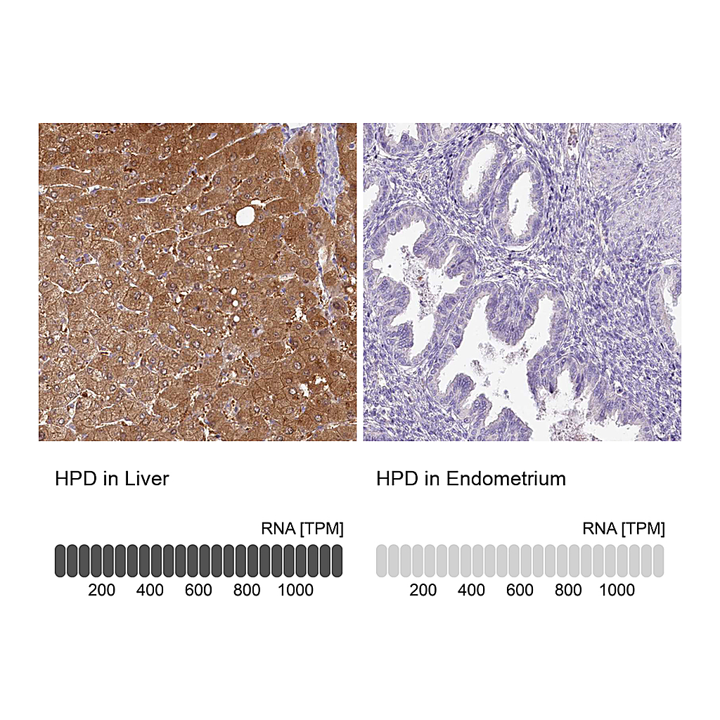 Atlas Antibodies Anti-HPD Antibody