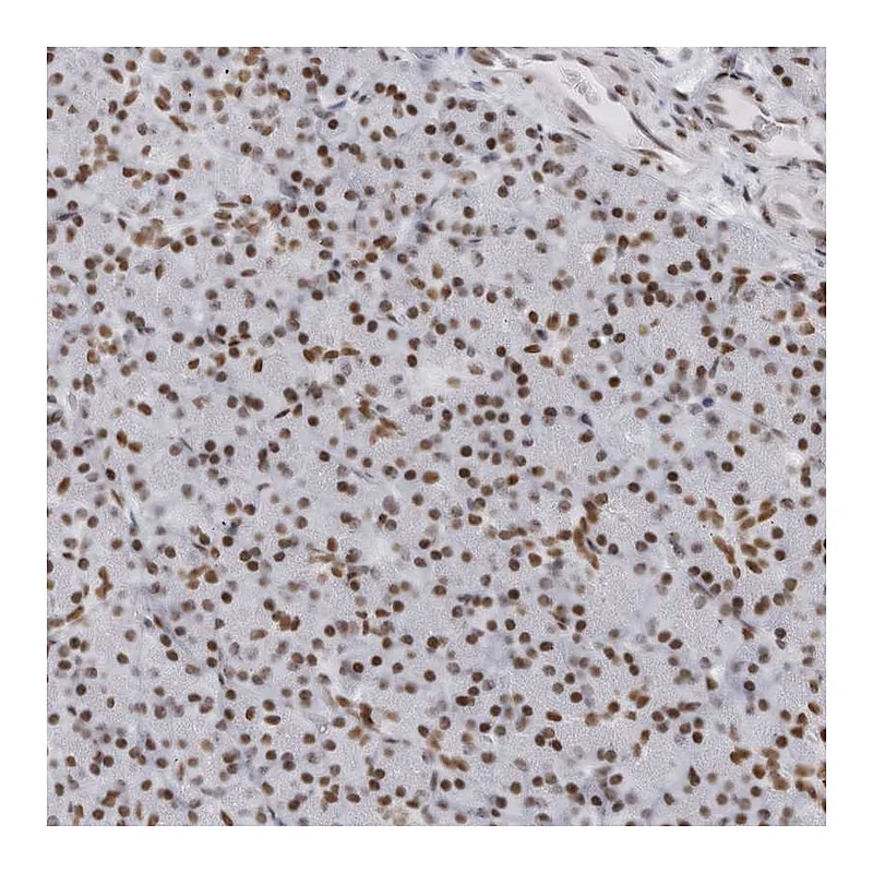 Atlas Antibodies Anti-HP1BP3 Antibody