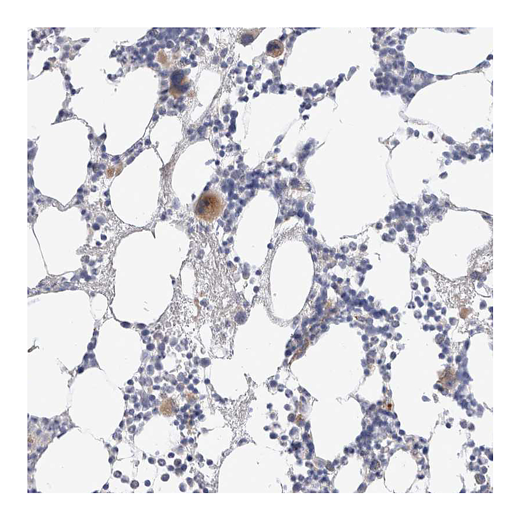Atlas Antibodies Anti-HPGDS Antibody
