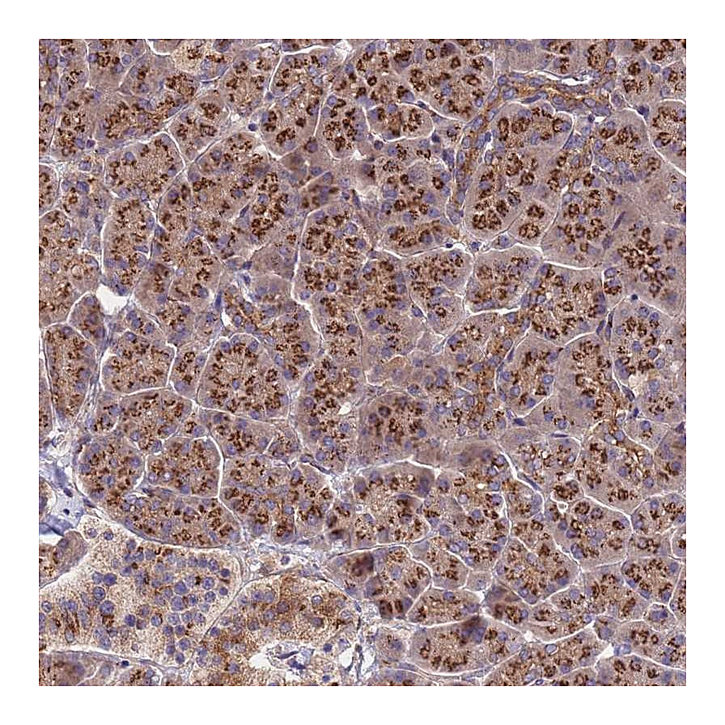Atlas Antibodies Anti-HPS3 Antibody
