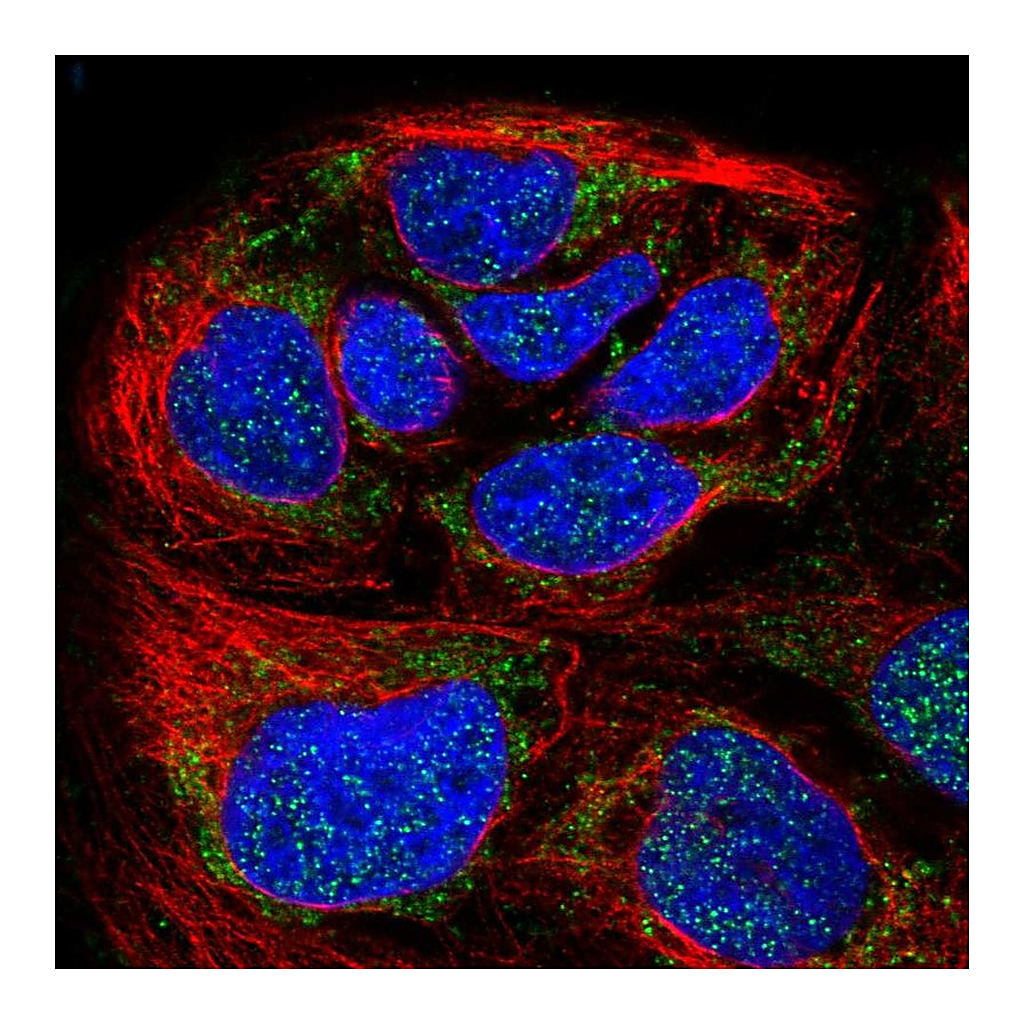 Atlas Antibodies Anti-HPDL Antibody