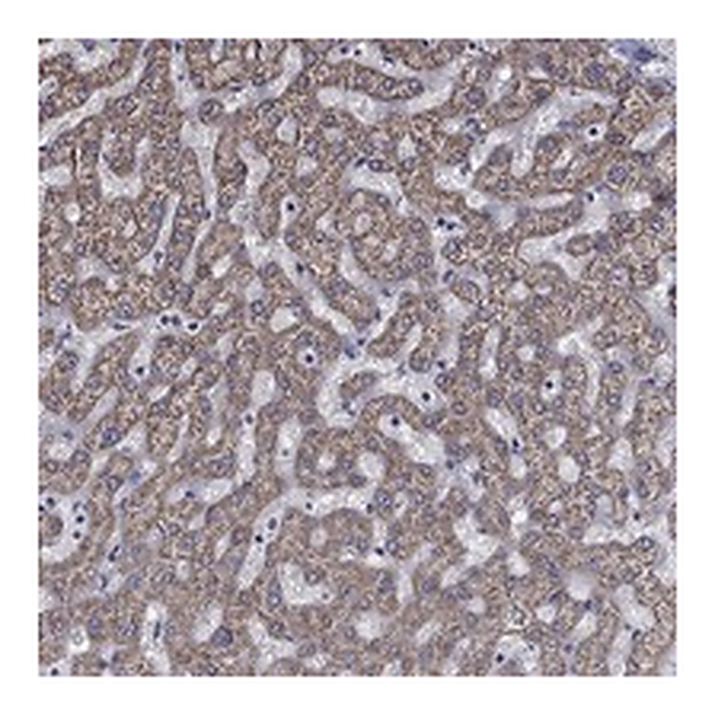 Atlas Antibodies Anti-HPS5 Antibody