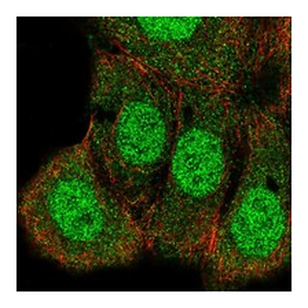 Atlas Antibodies Anti-HRAS Antibody