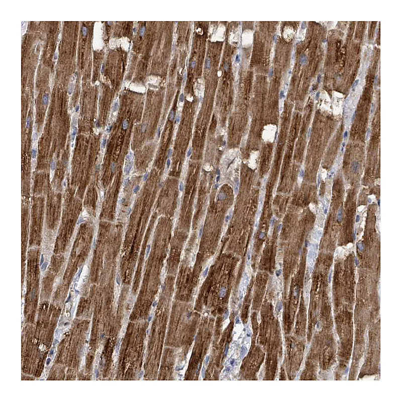 Atlas Antibodies Anti-HRASLS Antibody