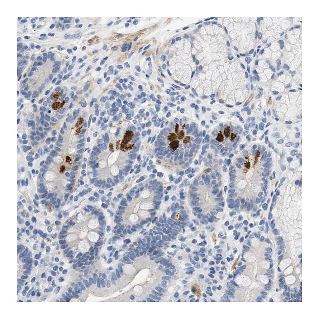 Atlas Antibodies Anti-HRH2 Antibody